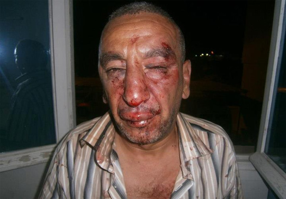 Tunisie - Photos des victimes de l'agression barbare des salafistes à Bizerte 