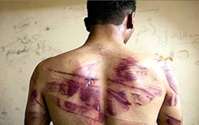 Naoufel Jammeli : La commission parlementaire compétente n'est pas apte à juger s'il y a eu torture