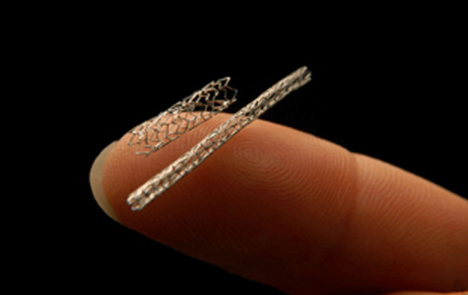 Affaire des Stents périmés, la CNAM soumet les dossiers à la justice