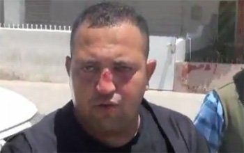 Cité Intilaka : Blessure de 7 agents parmi les forces de l'ordre (vidéo)