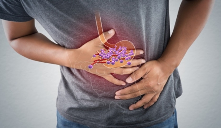 Escherichia coli : tout ce que vous devez savoir