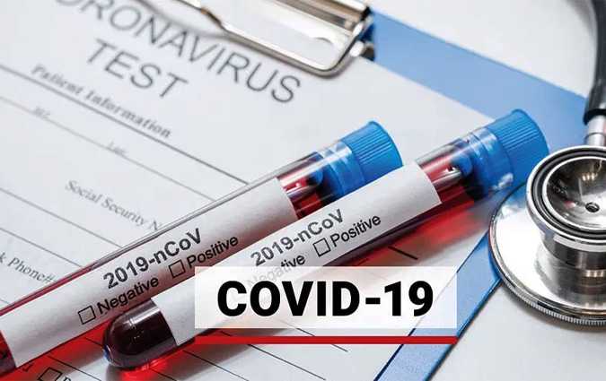 Bilan Covid-19 : 637 nouveaux cas et huit dcs