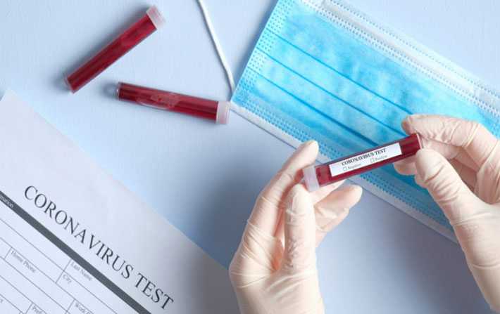 Covid-19 : cinq nouvelles contaminations importées
