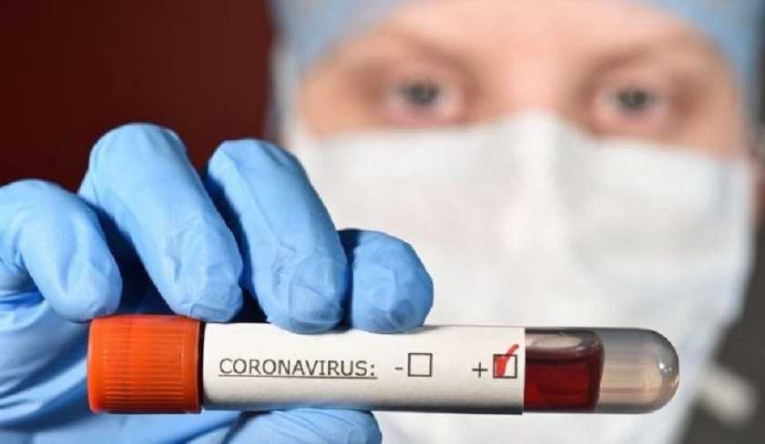 Covid-19 – Bilan : 8.315 nouveaux cas et 126 décès en 24h