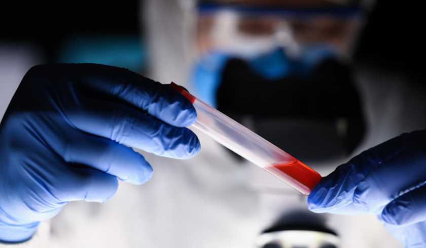 Tout sur le variant britannique du Coronavirus