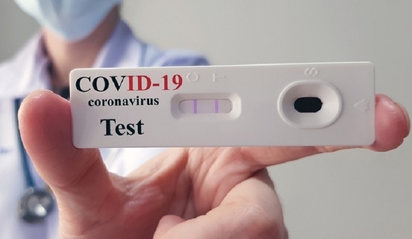 Bilan Covid-19 : 4.581 nouveaux cas et 34 dcs en une semaine