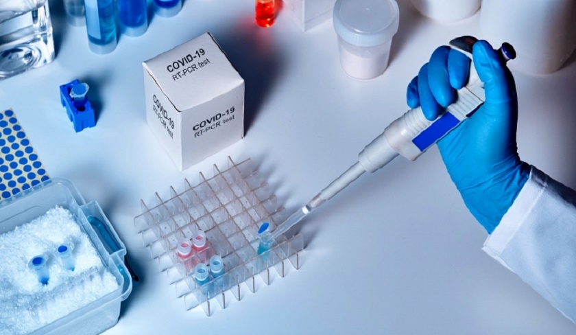 Le Syndicat des biologistes dnonce le trafic de rsultats contrefaits de tests RT-PCR
