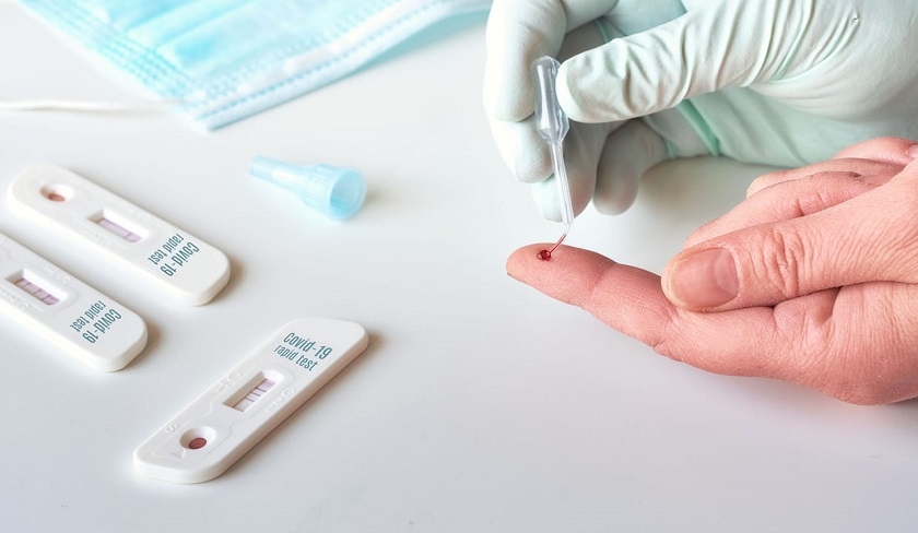CNOPT : La vente des tests rapides aux particuliers n’est pas autorisée