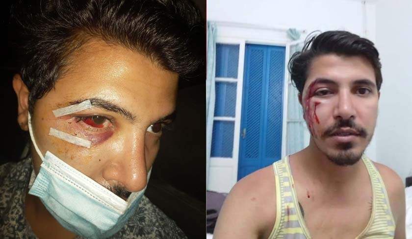 Entre Korbous et Soliman : Il subit le braquage et la violence de la police
