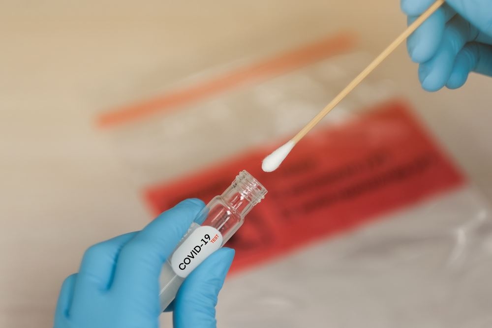 Bilan Covid-19 : 187 nouveaux cas et trois décès
