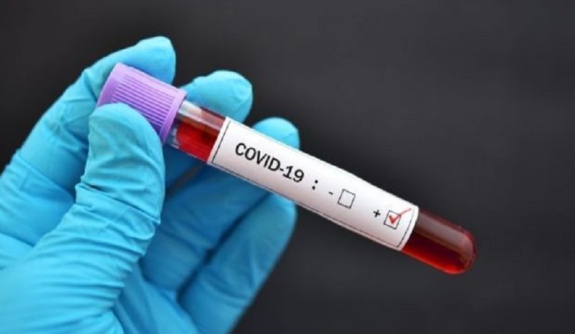 Bilan  Covid-19 : 72 nouvelles contaminations et deux dcs
