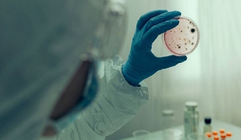 Qu’est ce que la variole du singe ou Monkeypox?