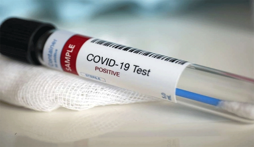 Bilan Covid-19 : un taux de contamination alarmant de 34,77% et 20 décès en une semaine