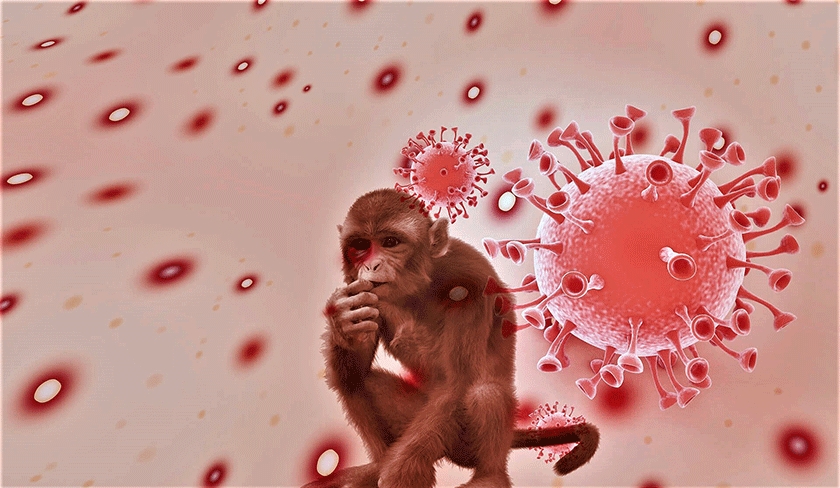 Aucun cas de variole du singe en Tunisie, d'après les autorités sanitaires

