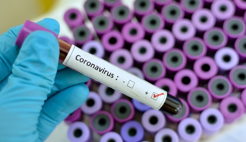 Covid-19 – Hechmi Louzir : Il n’y a toujours pas de sous-variant Eris en Tunisie