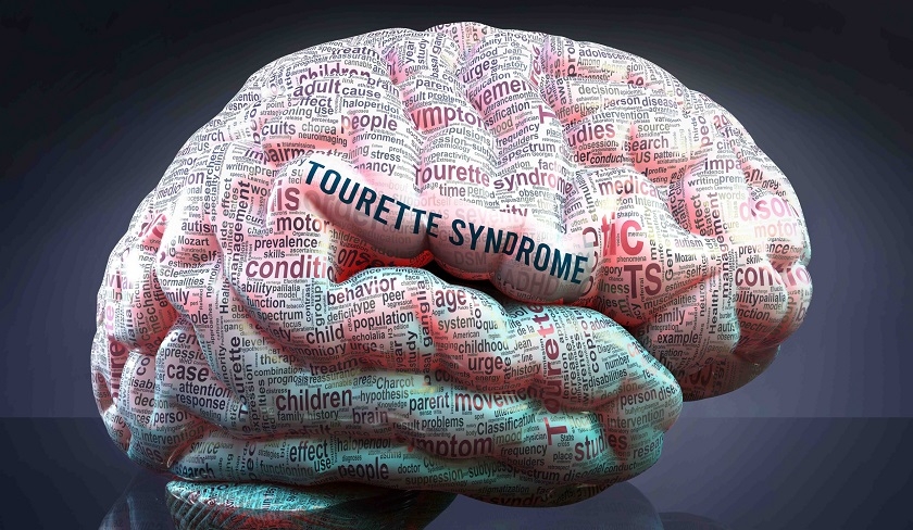 Tout ce que vous devez savoir sur le syndrome de Gilles de la Tourette !